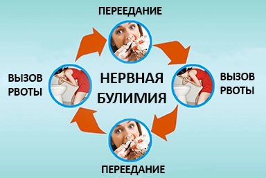 Лечение булимии в Казанской